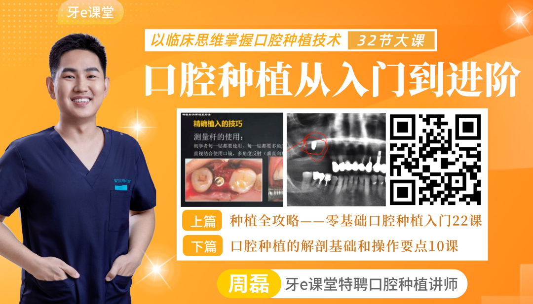 刮匙怎么使用牙龈分离器、刮匙简介_https://www.jmylbn.com_新闻资讯_第13张