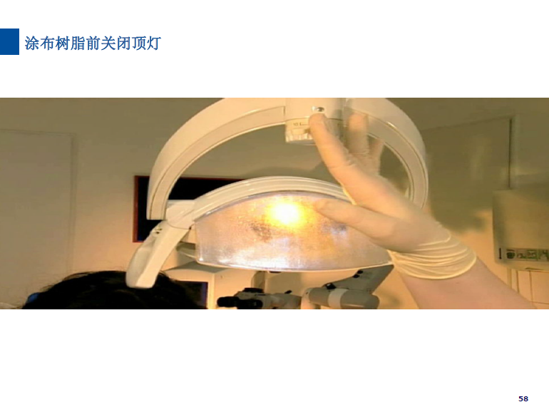 dmg口腔材料怎么使用德国DMG  Icon 渗透树脂，应该这样用……_https://www.jmylbn.com_新闻资讯_第58张