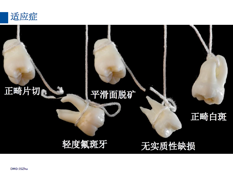 dmg口腔材料怎么使用德国DMG  Icon 渗透树脂，应该这样用……_https://www.jmylbn.com_新闻资讯_第44张