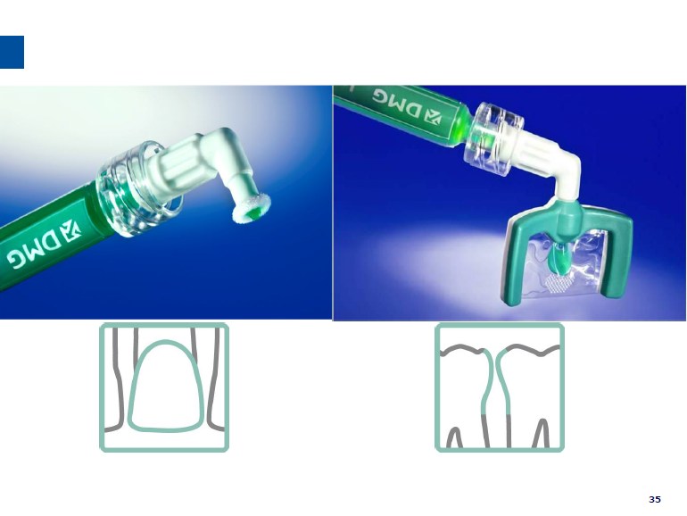 dmg口腔材料怎么使用德国DMG  Icon 渗透树脂，应该这样用……_https://www.jmylbn.com_新闻资讯_第38张