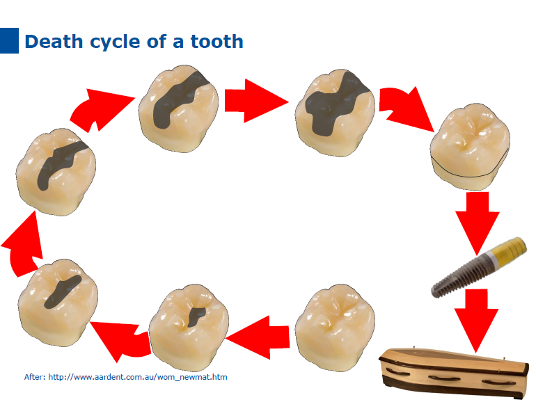 dmg口腔材料怎么使用德国DMG  Icon 渗透树脂，应该这样用……_https://www.jmylbn.com_新闻资讯_第26张