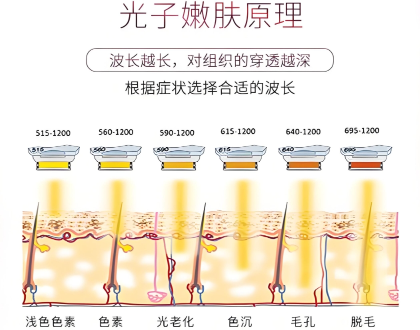 小长假轻医美推荐：恢复快、花费明、焕新颜，失明换眼费用解析与热门项目盘点