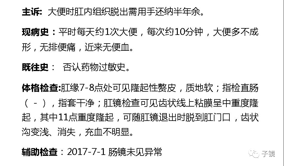痔疮吻合钉长什么样南方医院李胜龙教授“肛肠外科微创治痔大全”学习笔记_https://www.jmylbn.com_新闻资讯_第29张
