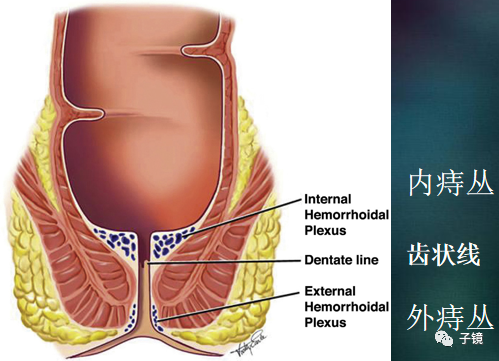 套扎环怎么下“中美专家谈内痔内镜下套扎治疗”学习笔记_https://www.jmylbn.com_新闻资讯_第2张
