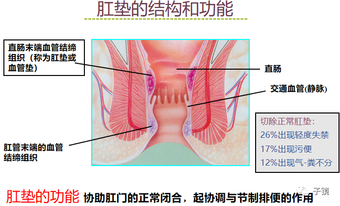套扎环怎么下“中美专家谈内痔内镜下套扎治疗”学习笔记_https://www.jmylbn.com_新闻资讯_第11张