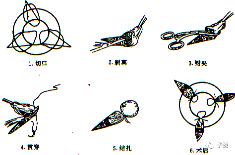 套扎环怎么下“中美专家谈内痔内镜下套扎治疗”学习笔记_https://www.jmylbn.com_新闻资讯_第14张