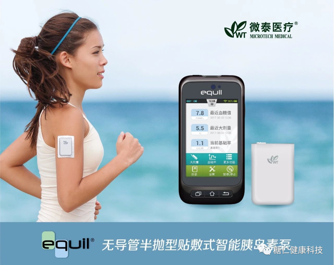 微泰胰岛素泵怎么样微泰贴敷式无管路胰岛素泵_https://www.jmylbn.com_新闻资讯_第2张