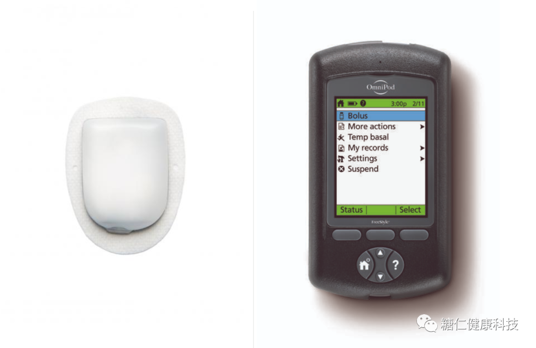 微泰胰岛素泵怎么样国内市场常见胰岛素泵大PK_https://www.jmylbn.com_新闻资讯_第5张