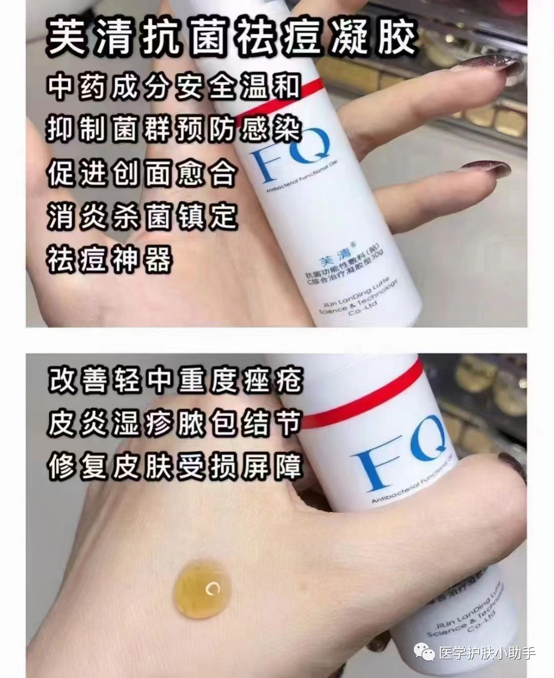 促愈凝胶怎么排出芙清凝医用促愈功能性敷料（芙清凝胶）_https://www.jmylbn.com_新闻资讯_第4张