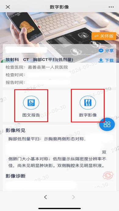 取片机怎么用便民利民 ｜ 取片不用跑 我院数字影像（云胶片）“码”上可见！还可下载保存噢～_https://www.jmylbn.com_新闻资讯_第5张