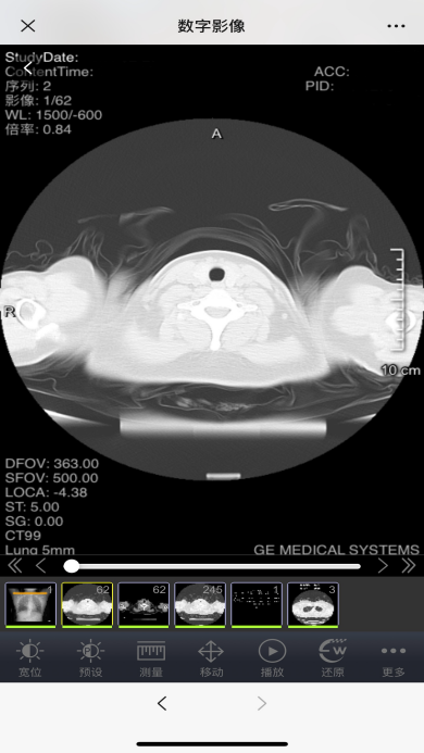 取片机怎么用便民利民 ｜ 取片不用跑 我院数字影像（云胶片）“码”上可见！还可下载保存噢～_https://www.jmylbn.com_新闻资讯_第6张