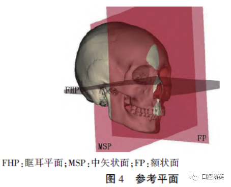 三维钛网是什么CAD／CAM制作个性化钛网联合髂骨移植重建单侧下颌骨大型轮廓缺损_https://www.jmylbn.com_新闻资讯_第7张