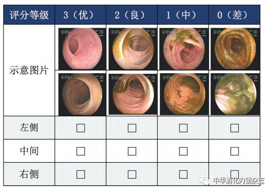 为什么说热活检钳​肠息肉切除术的一般步骤，5张图片教会你_https://www.jmylbn.com_新闻资讯_第3张