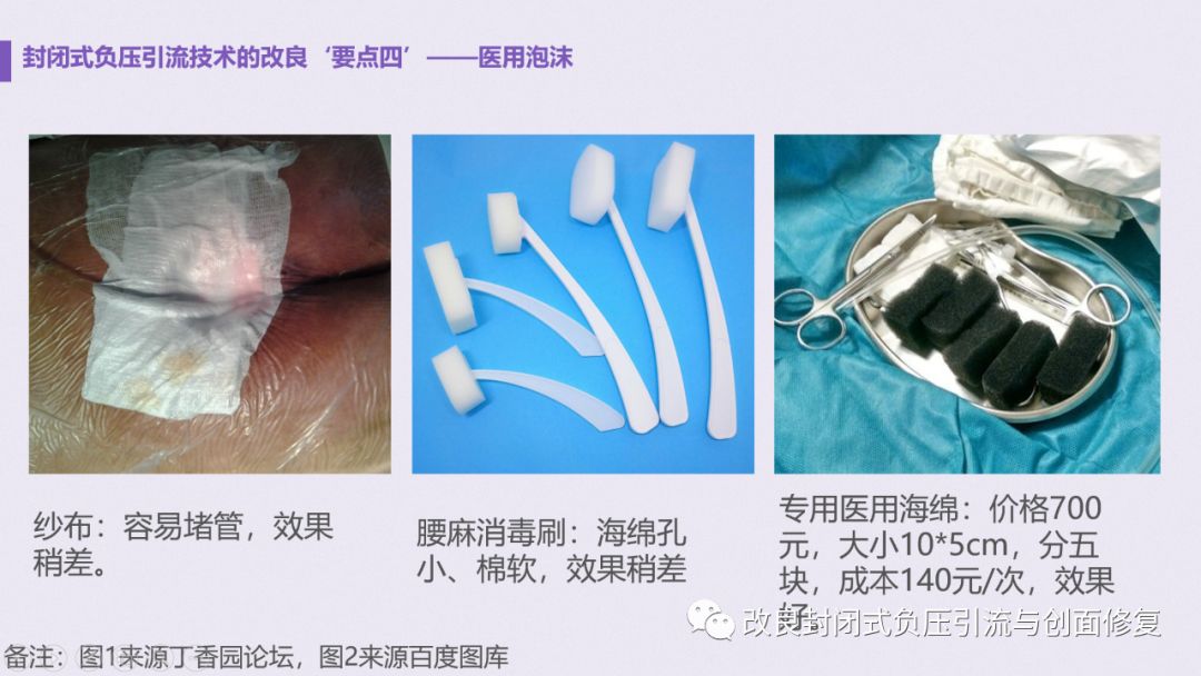 VSD怎么更换引流瓶简易封闭式负压引流：操作流程细节，视频配解说_https://www.jmylbn.com_新闻资讯_第6张