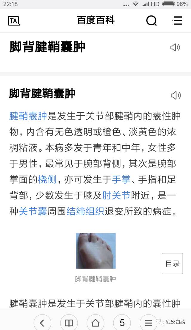 我的世界很小小到一个腱鞘囊肿就可以哭上半天