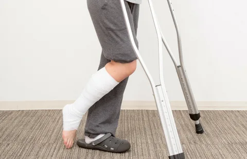 可调膝关节支具怎么用前叉术后“第三条腿”（支具）的使用_https://www.jmylbn.com_新闻资讯_第5张