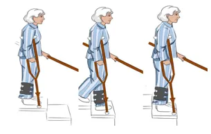 可调膝关节支具怎么用前叉术后“第三条腿”（支具）的使用_https://www.jmylbn.com_新闻资讯_第3张