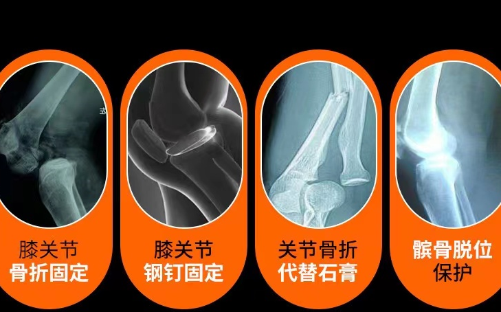 可调膝关节支具怎么用前叉术后“第三条腿”（支具）的使用_https://www.jmylbn.com_新闻资讯_第9张