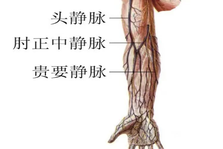 手术中怎么选择针手术室静脉输液，“针”不一样_https://www.jmylbn.com_新闻资讯_第11张