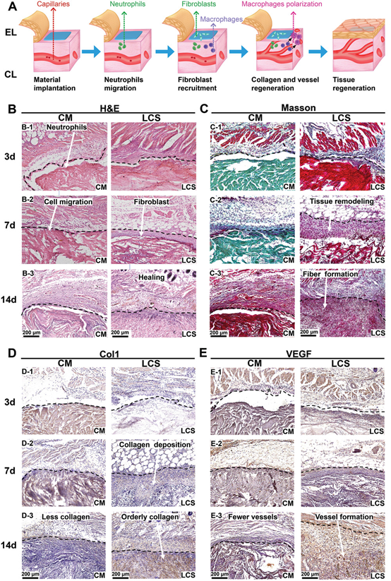 《AFM》中科大高怀岭/俞书宏院士、同济王佐林：仿生层状壳聚糖支架用于软牙龈组织再生的图5