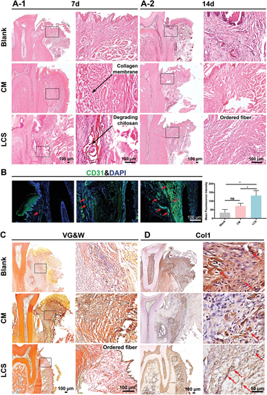 《AFM》中科大高怀岭/俞书宏院士、同济王佐林：仿生层状壳聚糖支架用于软牙龈组织再生的图6