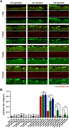 《Science Adv.》可注射光敏水凝胶，金属组装递送神经保护蛋白的图7