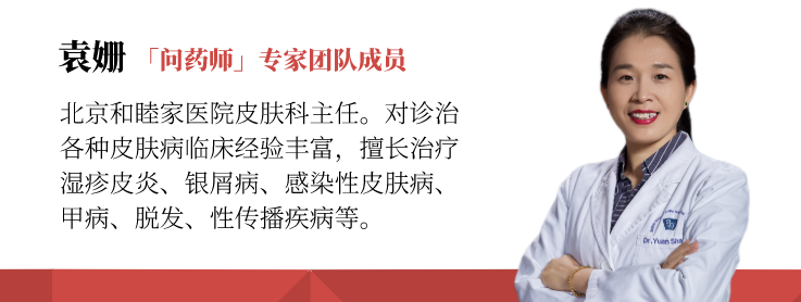 一文读懂「头皮脂溢性皮炎」