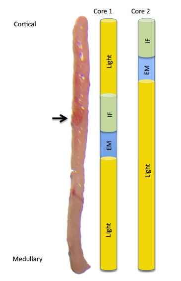 穿刺枪怎么升级肾脏穿刺活检术：入门教程_https://www.jmylbn.com_新闻资讯_第9张