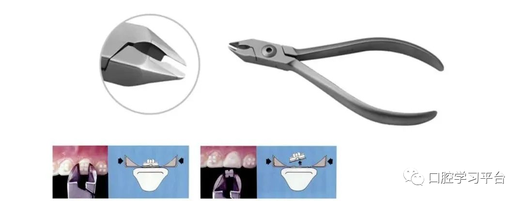 弓丝成型器怎么使用正畸 ｜ 正畸常用钳及附件，一篇认全！_https://www.jmylbn.com_新闻资讯_第21张