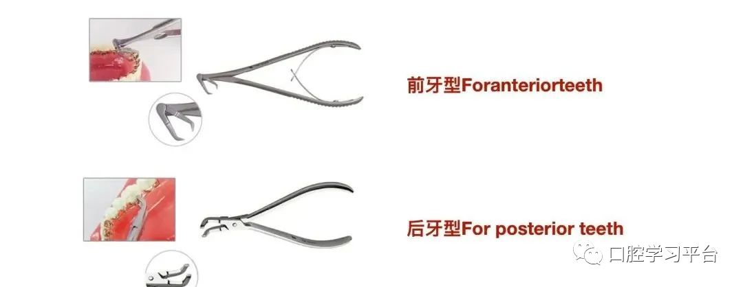 弓丝成型器怎么使用正畸 ｜ 正畸常用钳及附件，一篇认全！_https://www.jmylbn.com_新闻资讯_第38张