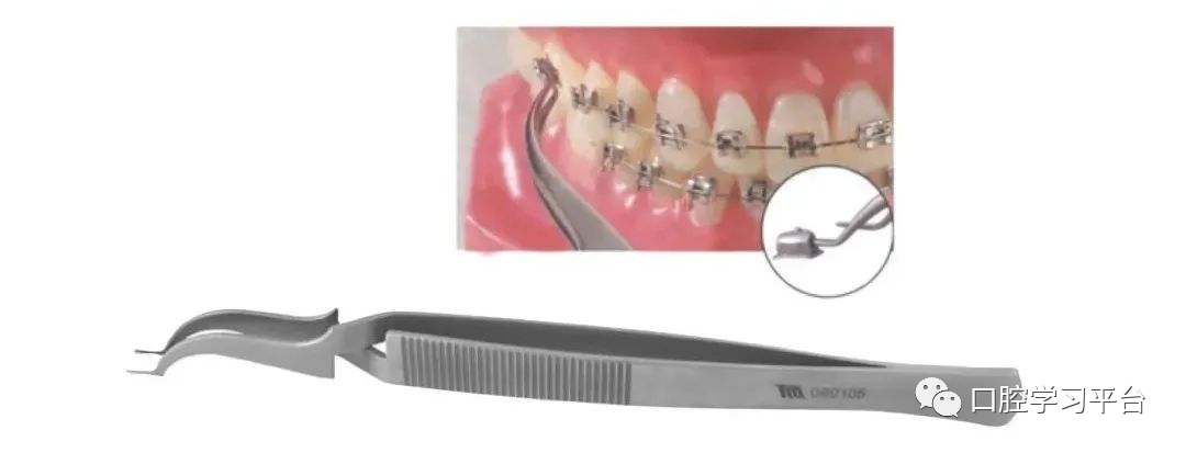弓丝成型器怎么使用正畸 ｜ 正畸常用钳及附件，一篇认全！_https://www.jmylbn.com_新闻资讯_第53张