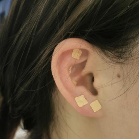 中药热奄包怎么蒸中医特色疗法：热奄包——古法今用的“暖宝宝”_https://www.jmylbn.com_新闻资讯_第19张