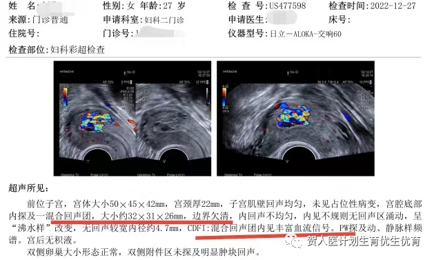 妇科微波治疗怎么做创新！微波消融术用于治疗子宫动静脉瘘_https://www.jmylbn.com_新闻资讯_第3张