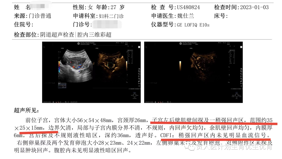 妇科微波治疗怎么做创新！微波消融术用于治疗子宫动静脉瘘_https://www.jmylbn.com_新闻资讯_第4张