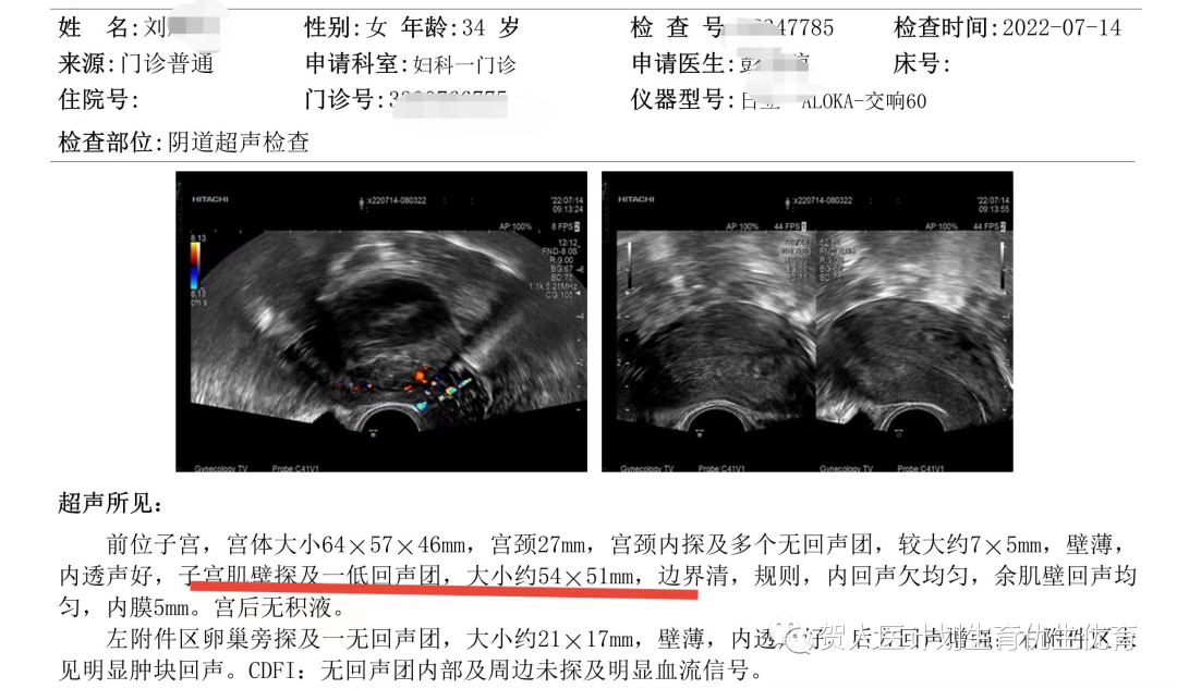 妇科微波治疗怎么做创新！微波消融术用于治疗子宫动静脉瘘_https://www.jmylbn.com_新闻资讯_第8张