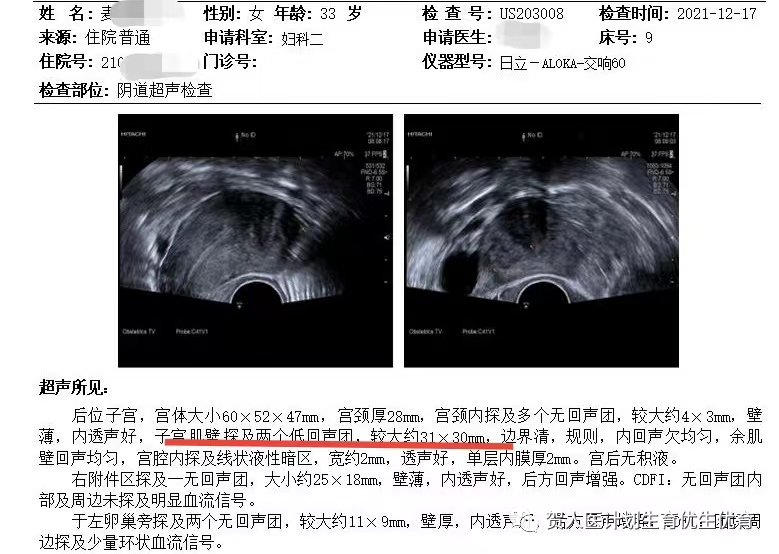 妇科微波治疗怎么做创新！微波消融术用于治疗子宫动静脉瘘_https://www.jmylbn.com_新闻资讯_第9张