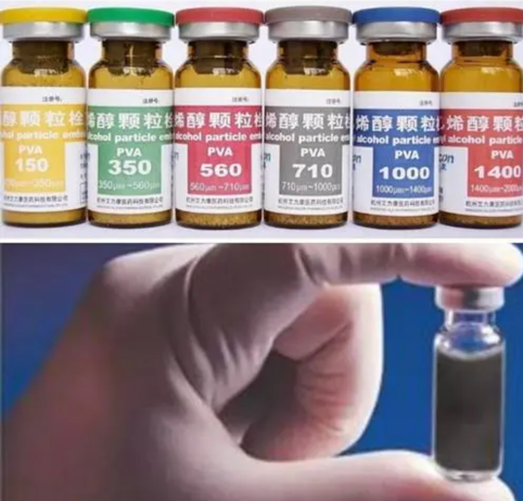 什么是介入耗材盘点介入医学中有哪些植入耗材？_https://www.jmylbn.com_新闻资讯_第11张