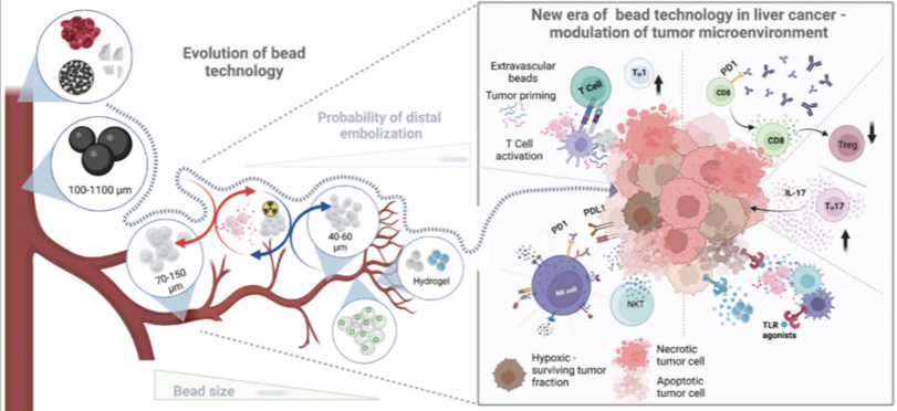 什么是介入耗材盘点介入医学中有哪些植入耗材？_https://www.jmylbn.com_新闻资讯_第10张