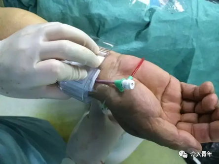 手术帽怎么消毒中山二院事件后思考：需注意介入手术室的院感防控_https://www.jmylbn.com_新闻资讯_第6张