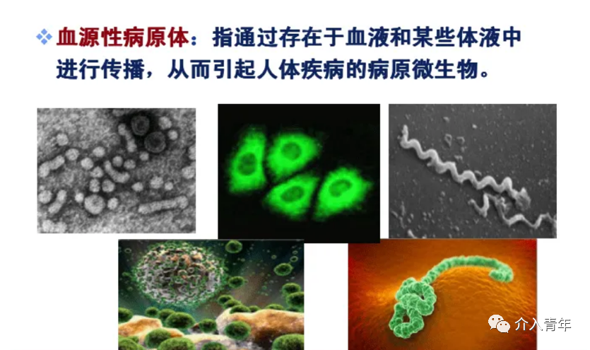 手术帽怎么消毒中山二院事件后思考：需注意介入手术室的院感防控_https://www.jmylbn.com_新闻资讯_第11张