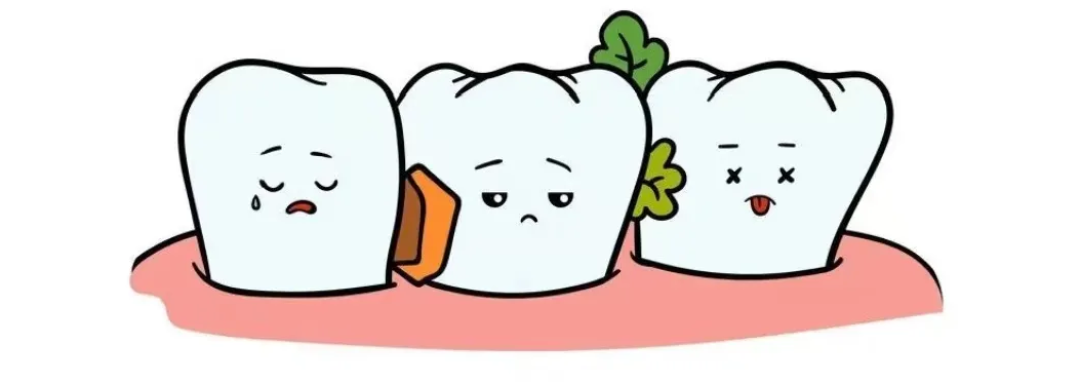 激光和电刀区别是什么为什么要剪舌系带？_https://www.jmylbn.com_新闻资讯_第18张