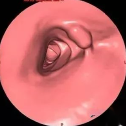 电子直肠镜怎么做CT也能做“肠镜”了！？ 不用插管！不用脱裤子_https://www.jmylbn.com_新闻资讯_第4张