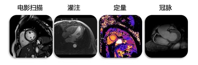 磁共振矩阵怎么计算有“温度”的智能检测仪器！助力医生更快速精准诊断疾病_https://www.jmylbn.com_新闻资讯_第8张