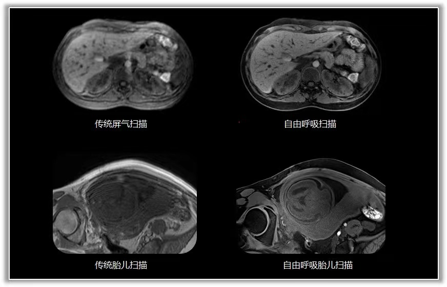 磁共振矩阵怎么计算有“温度”的智能检测仪器！助力医生更快速精准诊断疾病_https://www.jmylbn.com_新闻资讯_第5张
