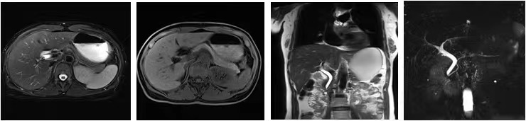 磁共振矩阵怎么计算有“温度”的智能检测仪器！助力医生更快速精准诊断疾病_https://www.jmylbn.com_新闻资讯_第6张