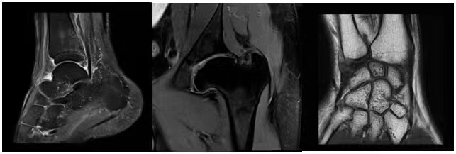磁共振矩阵怎么计算有“温度”的智能检测仪器！助力医生更快速精准诊断疾病_https://www.jmylbn.com_新闻资讯_第7张
