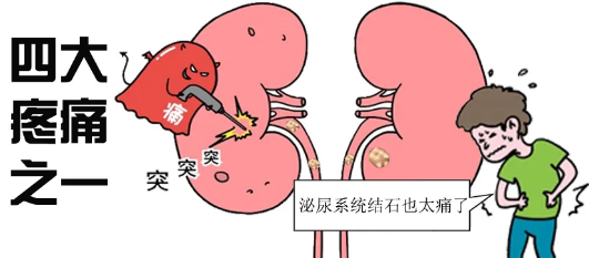 体外碎石b超怎么定位全电脑B超定位体外冲击波碎石│得了输尿管结石别紧张，区中医院碎石科有实招！_https://www.jmylbn.com_新闻资讯_第2张