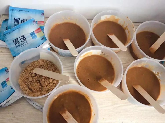 胃造影用的是什么机子“胃”爱守护——我院超声科引进胃肠超声造影检查新技术_https://www.jmylbn.com_新闻资讯_第2张