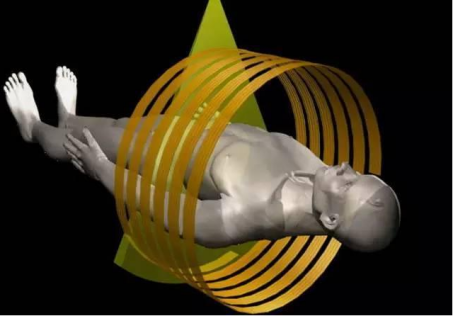 x光和dr有什么区别DR（X线）、CT、核磁（MR）到底有什么区别？（二）_https://www.jmylbn.com_新闻资讯_第1张