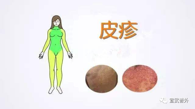 7,毛发生长异常,可能导致脱发,头发变干等.